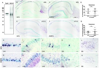 Genetic Background Influences the Propagation of Tau Pathology in Transgenic Rodent Models of Tauopathy